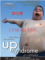 Up Syndrome